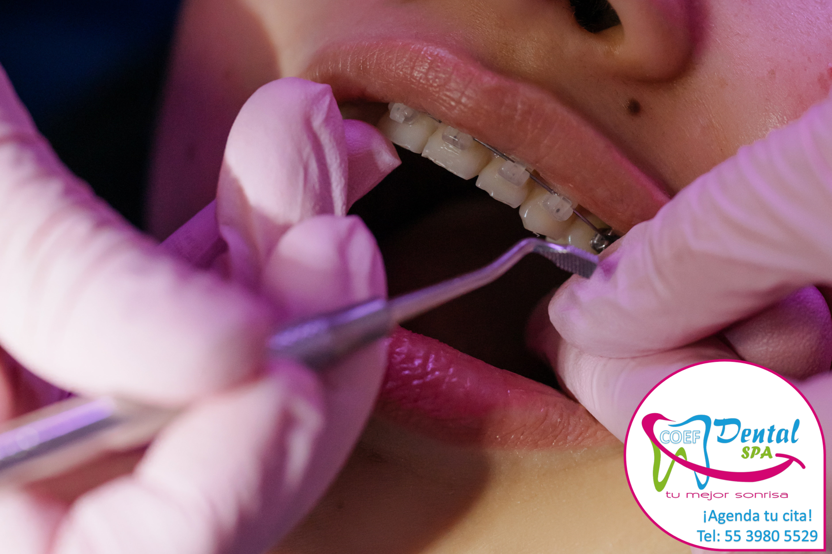 Ortodoncia - COEF Dental SPA